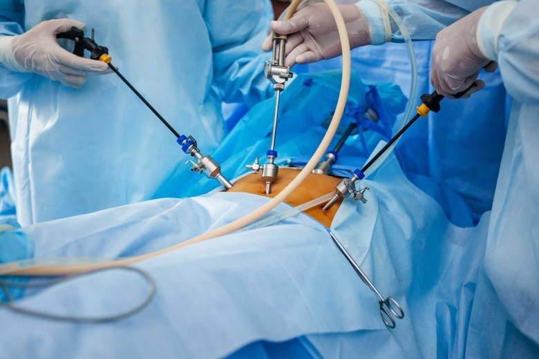 Best Gynae Laparoscopic Surgeon in Bangalore