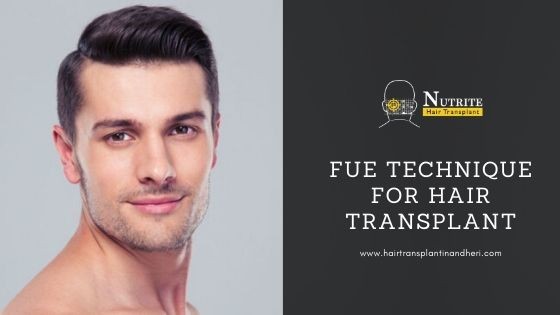 FUE Technique For Hair Transplant
