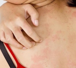 best allergy hospital in jaipur