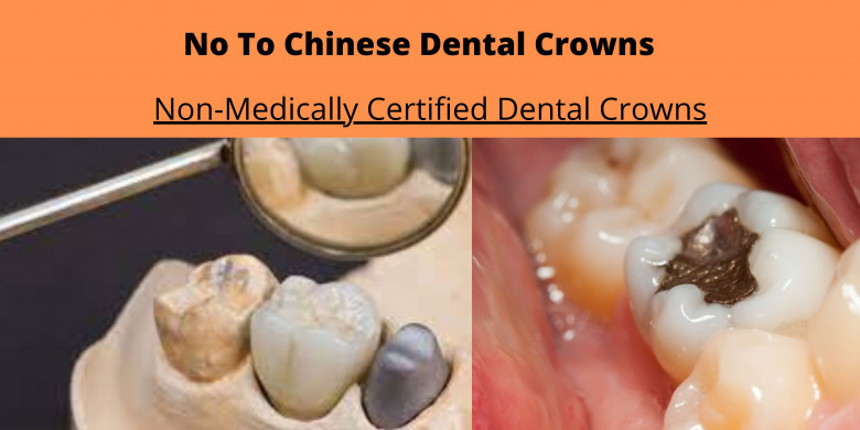 Chinese Teeth Crowns