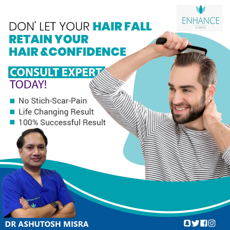 Best Hair Transplant in Delhi