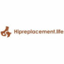 Hipreplacement