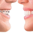 Best Dental in Saudi Arabia, Dentist Implants in Riyadh, Top Dentistry