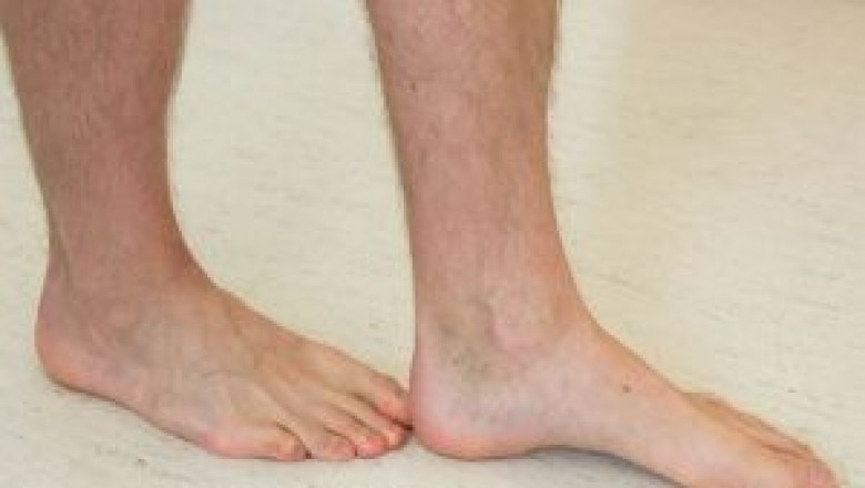 Vestibular Rehabilitation Service in Ottawa  | Vestibular Rehab Service in Ottawa