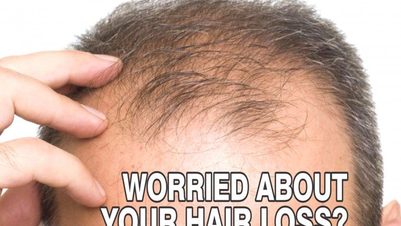 Hair Loss Treatment in Bangalore | PRP Treatment for Hair Loss in Bangalore