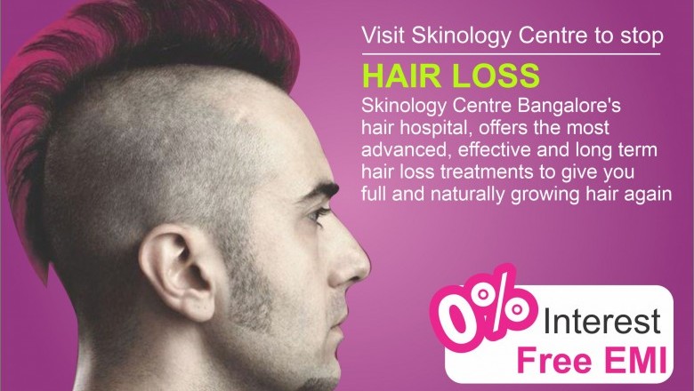 Hair Transplant Cost in Bangalore | FUE Hair Transplant @ Rs.29,999/