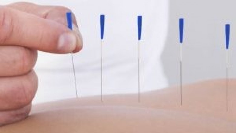  Chinese acupuncture  |  Acupuncture for anxiety  |  Acupuncture treatment