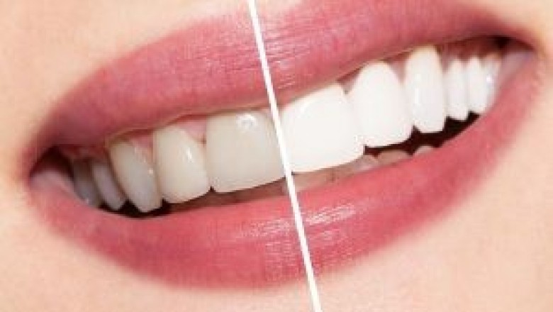 Rosedale Dental Care