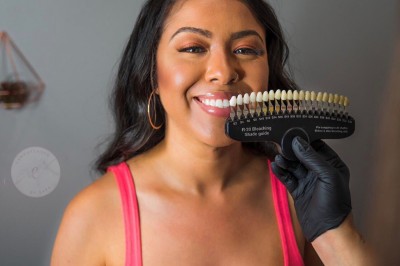 Advantages Of Undergoing Professional Teeth Whitening