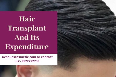 How The Cost Of A Hair Transplant Process Is Decided