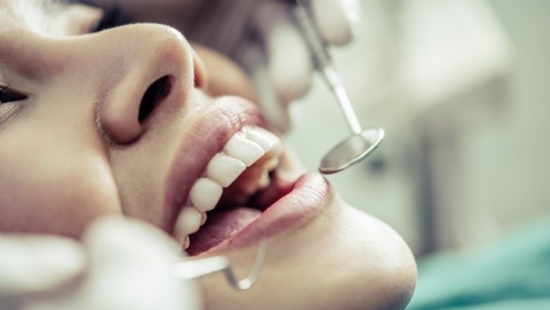 What Can You Expect From Dental Implants?