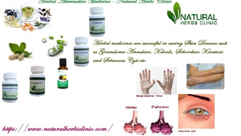 Natural Herbs Clinic - Herbal Alternative Medicine - Natural Herbal Clinic