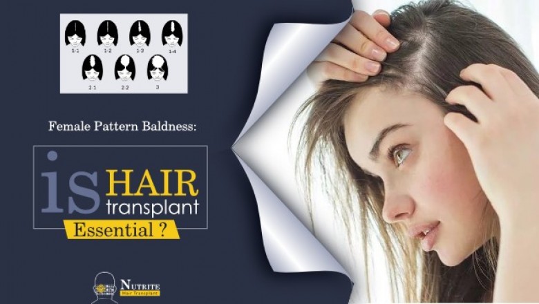 Female Pattern Baldness: is hair transplant essential?