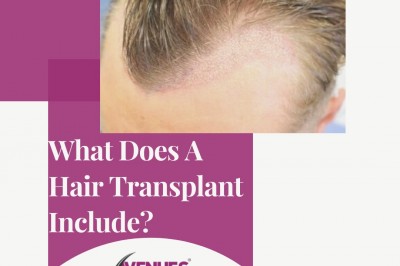 Have You Been Wondering Which Is The Right Hair Transplant For You?