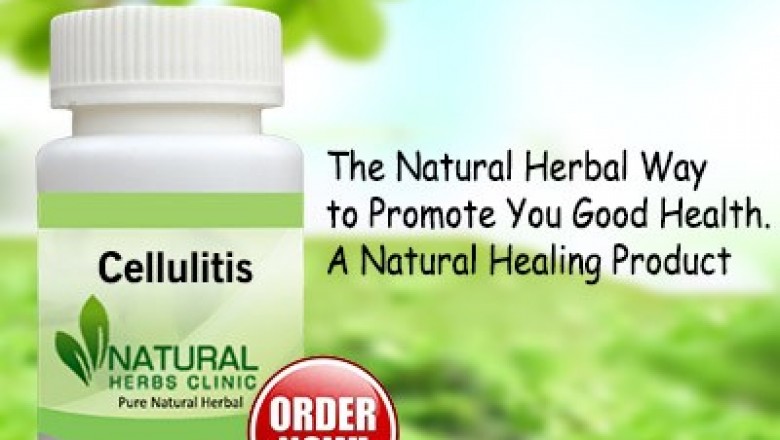Herbal Treatment for Cellulitis - Natural Herbs Clinic