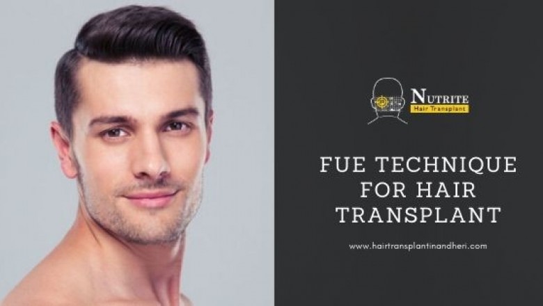 Why Choose FUE Technique for Hair Transplant?