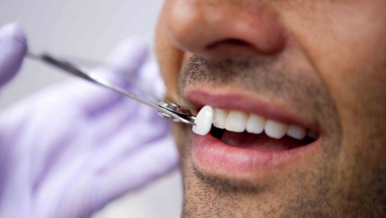   Restorative Dentistry