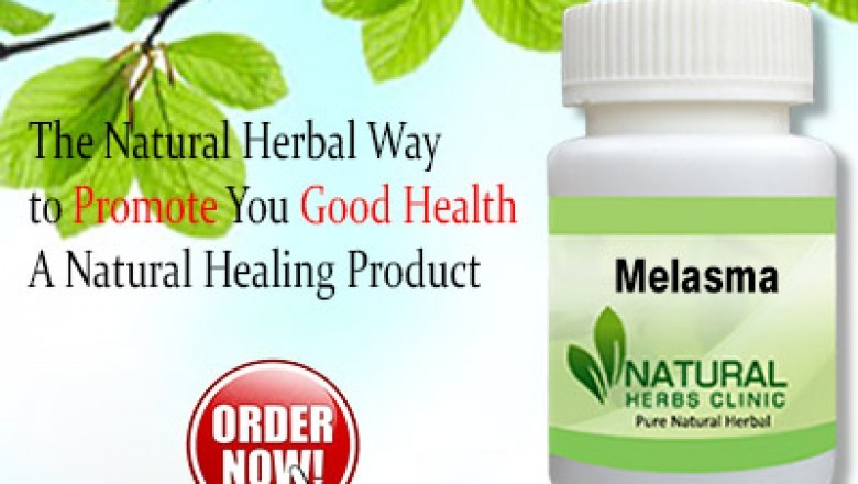 Natural Herbal Treatment for Melasma