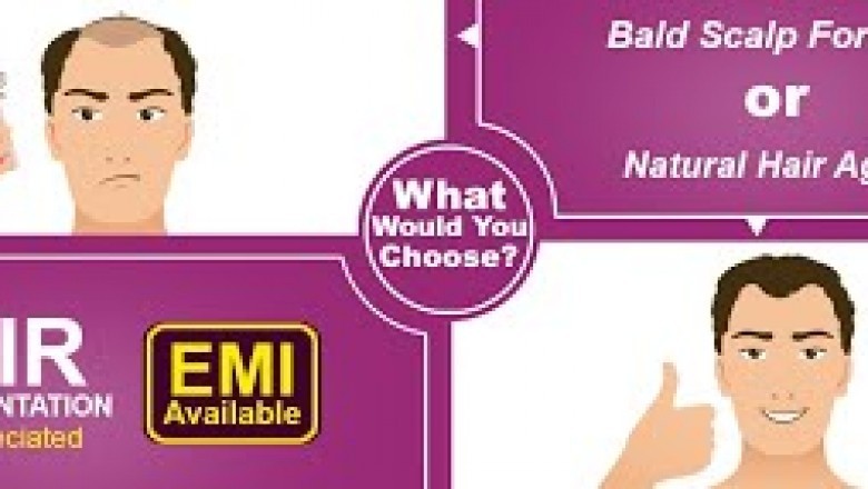 What Causes A Poor Hair Transplant Result And Methods Of Prevention & Correction