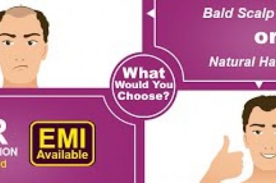 What Causes A Poor Hair Transplant Result And Methods Of Prevention & Correction