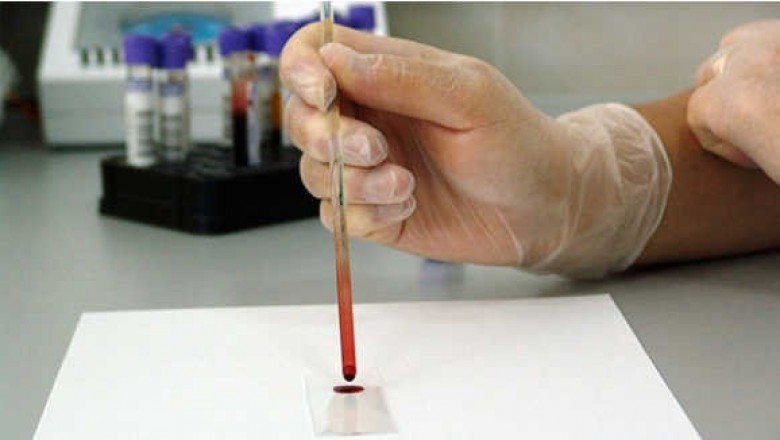 Use Lab Test Reviews To Go Through A Safe Testing Procedure!