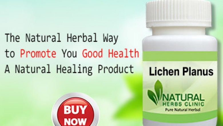 5 Home Remedies for Lichen Planus