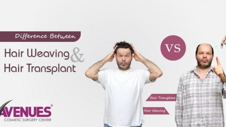 Difference Between Hair Weaving and Hair Transplant