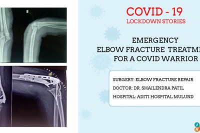 Elbow Fracture Treatment By Joint Replacement surgeon in Mulund