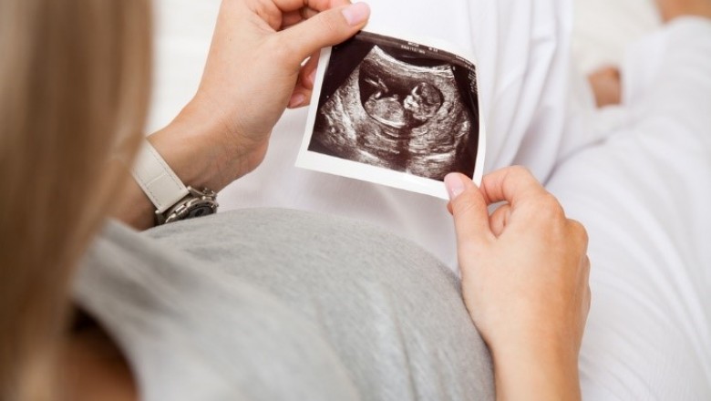 Pregnancy Test and Its Different Types