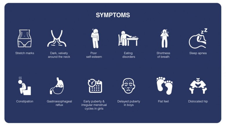 Obesity in Children : Complications and Prevention
