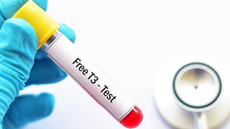 Know about Free Triiodothyronine (FT3) Test