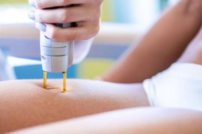 laser hair removal technique by veet