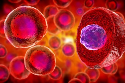 Stem Cell Treatment