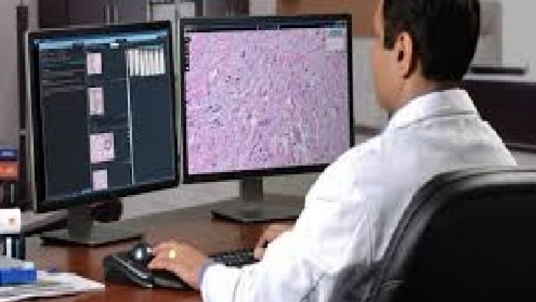 Global Digital Pathology Market Trends, Size, Forecast - 2018-2023