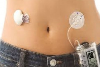 Global Disposable Medical Sensor Market Trends, Size, Forecast - 2019-2025