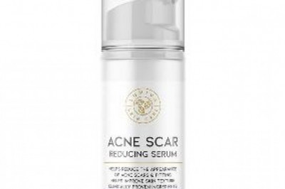 3 Facts You have to Know for Productive Acne Scar Treatment
