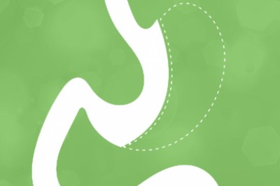 GASTRIC SLEEVE SURGERY - DR. RAMOS KELLY