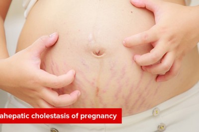 Intrahepatic cholestasis of pregnancy