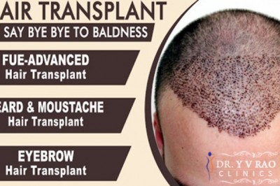 Hair Transplant in Hyderabad | Hair Transplant Cost | Dr.Yv Rao Clinics