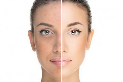 Best Advanced Skin care Solutions and Tips For Skincare 2020