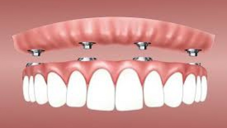 Dentist Lewis Center