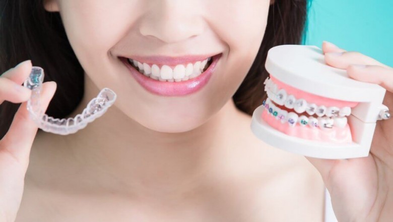 How Are the Options Similar for Invisalign