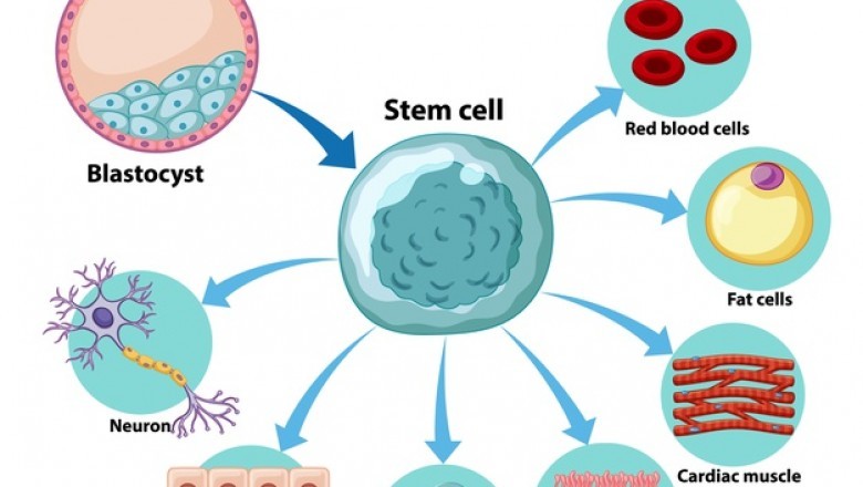 Stem Cell Transplants Purpose