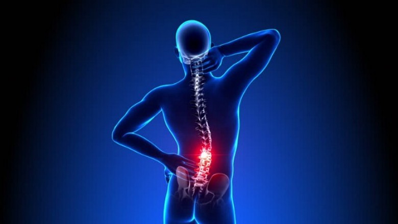 Back Pain: Causes and Non-Surgical Treatment