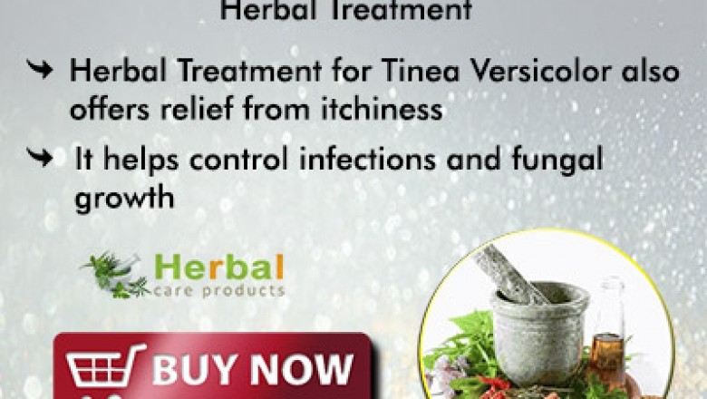 Herbal Treatment for Tinea Versicolor - Herbal Care Products