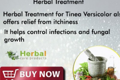 Herbal Treatment for Tinea Versicolor - Herbal Care Products