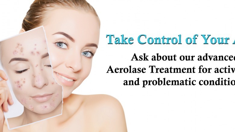 Acne Scar Removal Boston