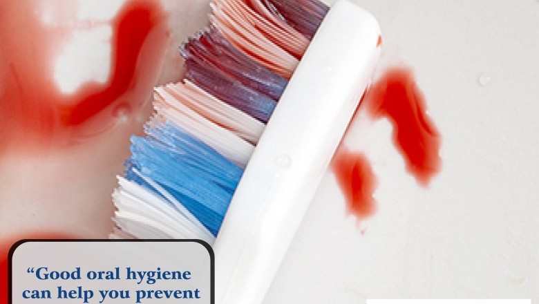 Dental Hygiene | Emergency Dental Services