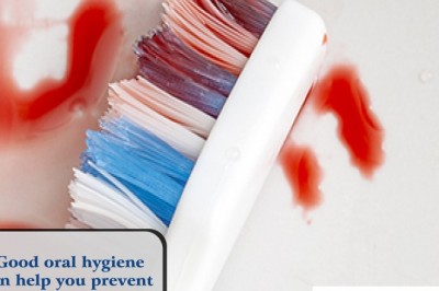 Dental Hygiene | Emergency Dental Services
