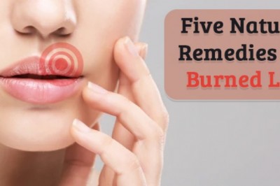 Five Natural Remedies for Burned Lips